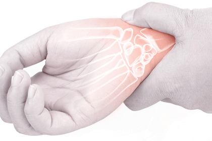 carpal tunnel physical therapy surgery milwaukee
