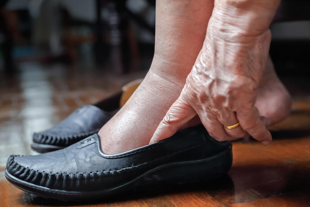 Where to Find Lymphedema Therapy in Havelock, North Carolin