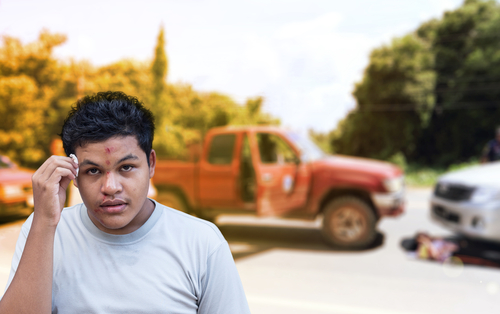 3 common car accident-related face injuries shutterstock 594651215 car accident face injuries